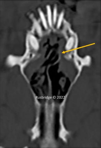 Figure 1 Dorsal CT